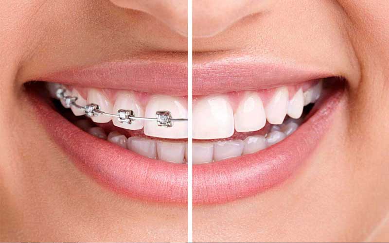 ameli dental clinic karaj